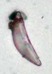 Cymbella
