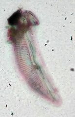 Cymbella