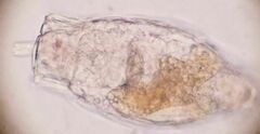 Rotifera