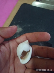 Semicassis granulata