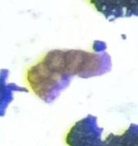 Pseudotrochamminita malcolmi