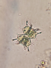 Staurastrum furcatum