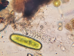 Rotifera