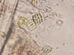 Scenedesmaceae