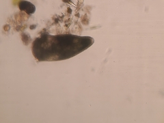 Stentor amethystinus