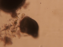 Stentor amethystinus