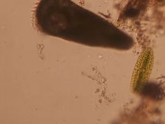 Stentor amethystinus