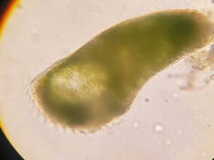 Stentor amethystinus