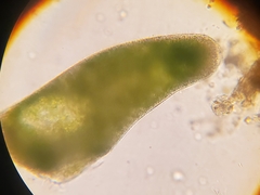 Stentor amethystinus