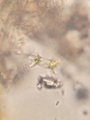 Staurastrum elongatum