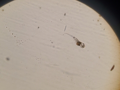 Cephalodella mucronata