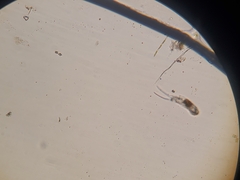 Cephalodella mucronata