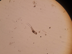 Cephalodella mucronata