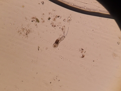 Cephalodella mucronata