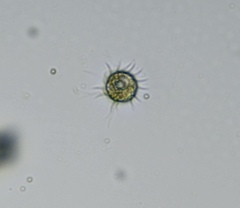 Oligotrichia
