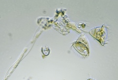 Vorticella