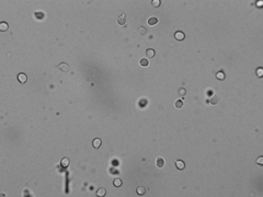 Hohenbuehelia angustata
