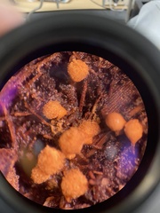 Hemitrichia calyculata