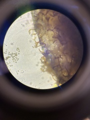 Hemitrichia calyculata