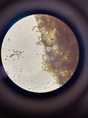 Hemitrichia calyculata