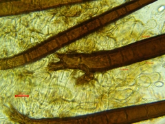 Scutellinia vitreola