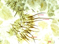 Scutellinia vitreola