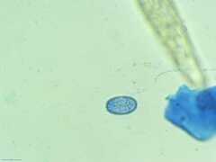 Scutellinia vitreola