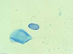 Scutellinia vitreola