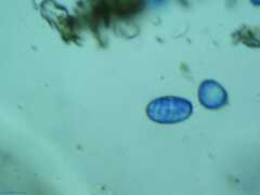 Scutellinia colensoi