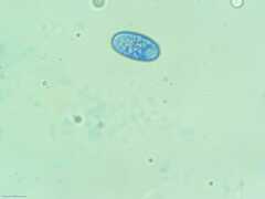 Scutellinia colensoi