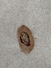 Ceroplastes sinensis