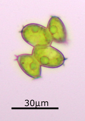 Desmodesmus denticulatus