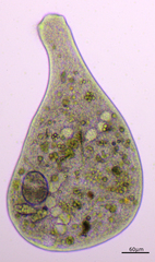 Stentor coeruleus