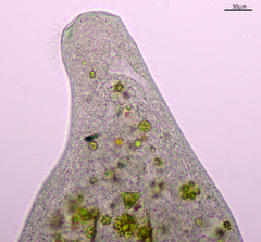 Stentor coeruleus