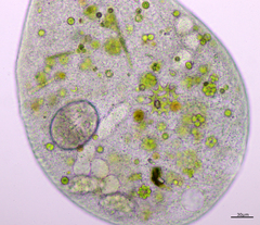 Stentor coeruleus