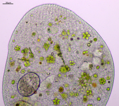 Stentor coeruleus