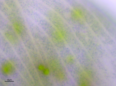 Stentor coeruleus
