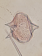 Protoperidinium