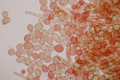 Botryobasidium conspersum