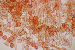 Botryobasidium conspersum