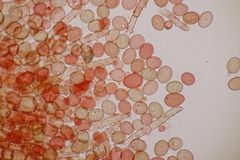 Botryobasidium conspersum