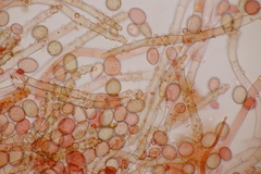 Botryobasidium conspersum