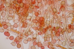 Botryobasidium conspersum