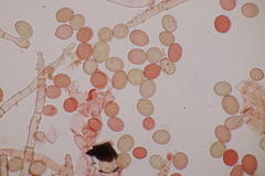 Botryobasidium conspersum