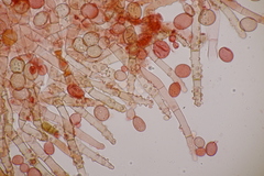Botryobasidium conspersum
