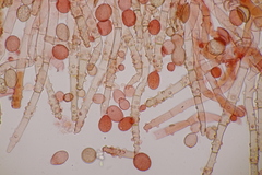 Botryobasidium conspersum