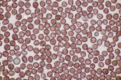 Sphacelotheca hydropiperis