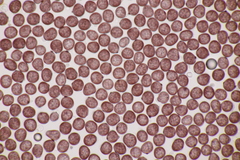 Sphacelotheca hydropiperis