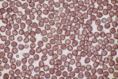 Sphacelotheca hydropiperis