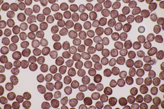 Sphacelotheca hydropiperis